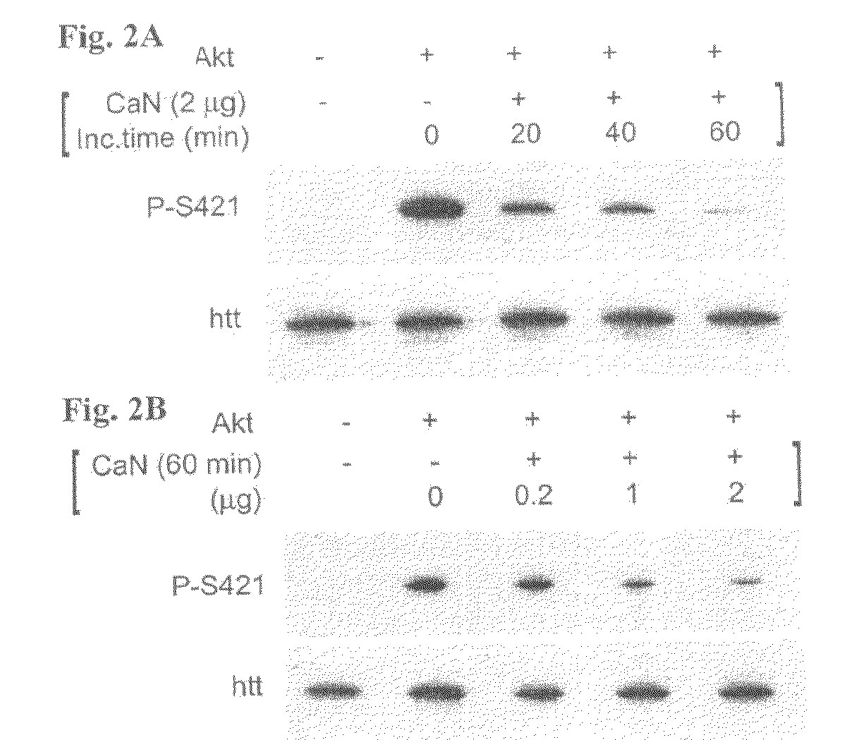 Method For Treating Huntington's Disease by Inhibiting Dephosphorylation of Huntingtin at S421