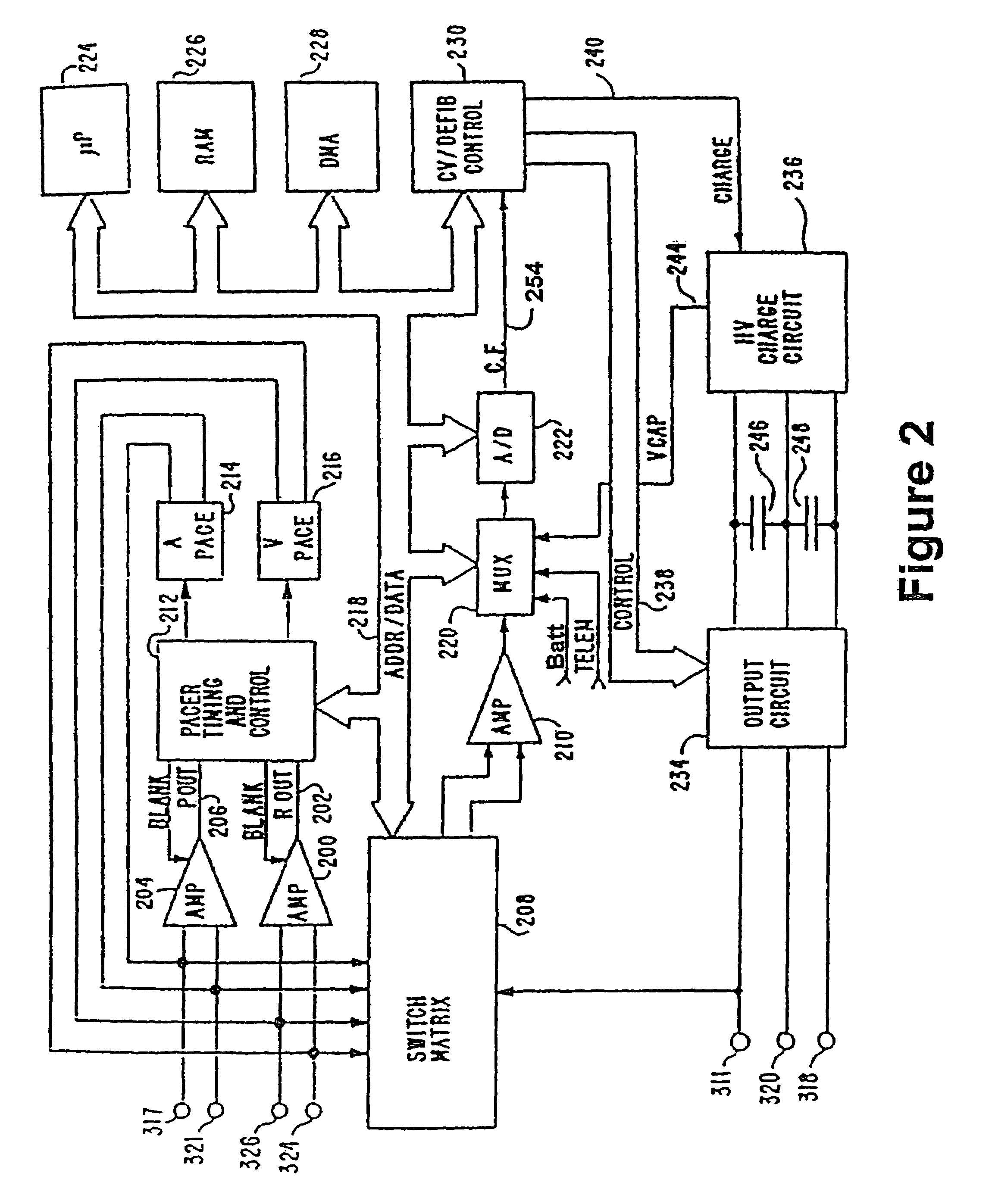 Implantable medical device with sleep disordered breathing monitoring