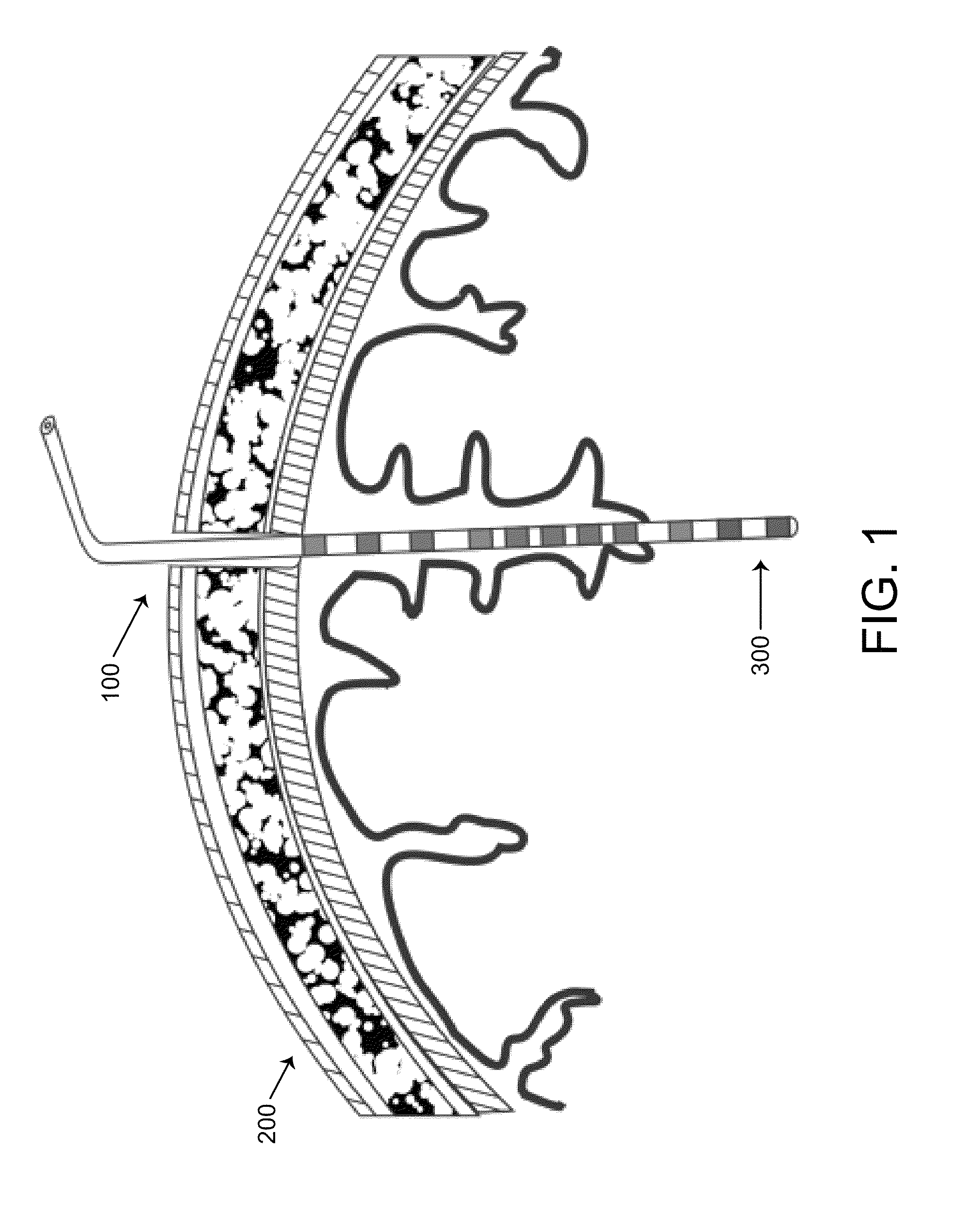 Method, system and apparatus for remote neural modulation brain stimulation and feedback control