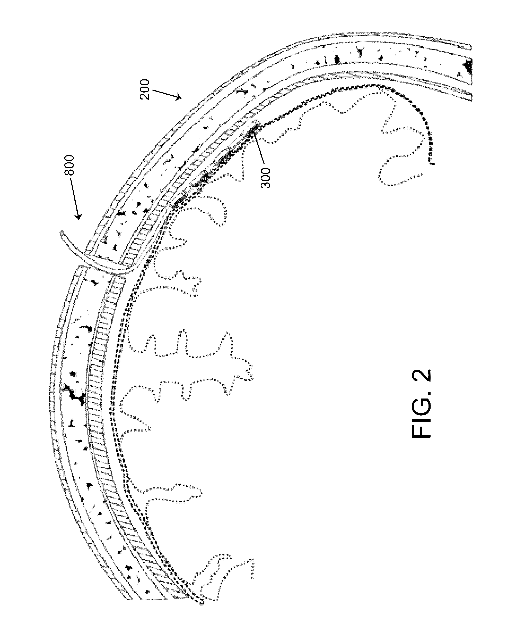 Method, system and apparatus for remote neural modulation brain stimulation and feedback control