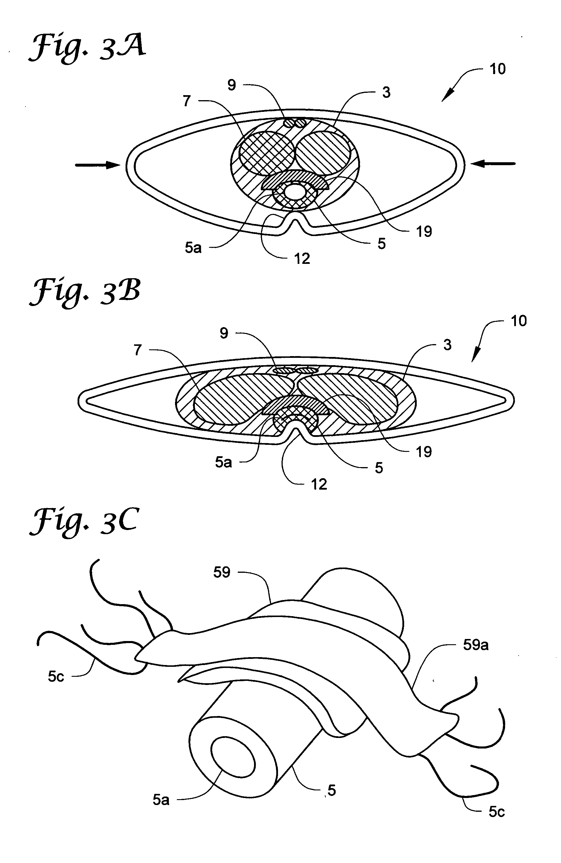 Penile compression device