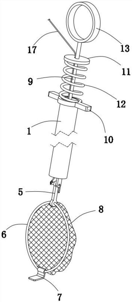 Gallstone extractor