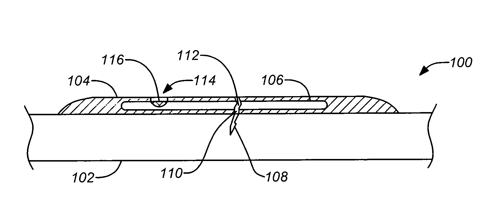 Fracture detecting structural health sensor