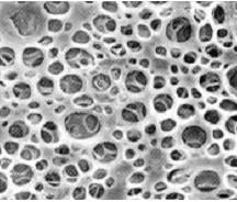 Method for preparing high-intensity three-dimensional chitosan porous bracket