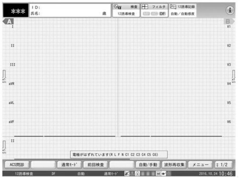 ECG waveform display method and ECG analysis device