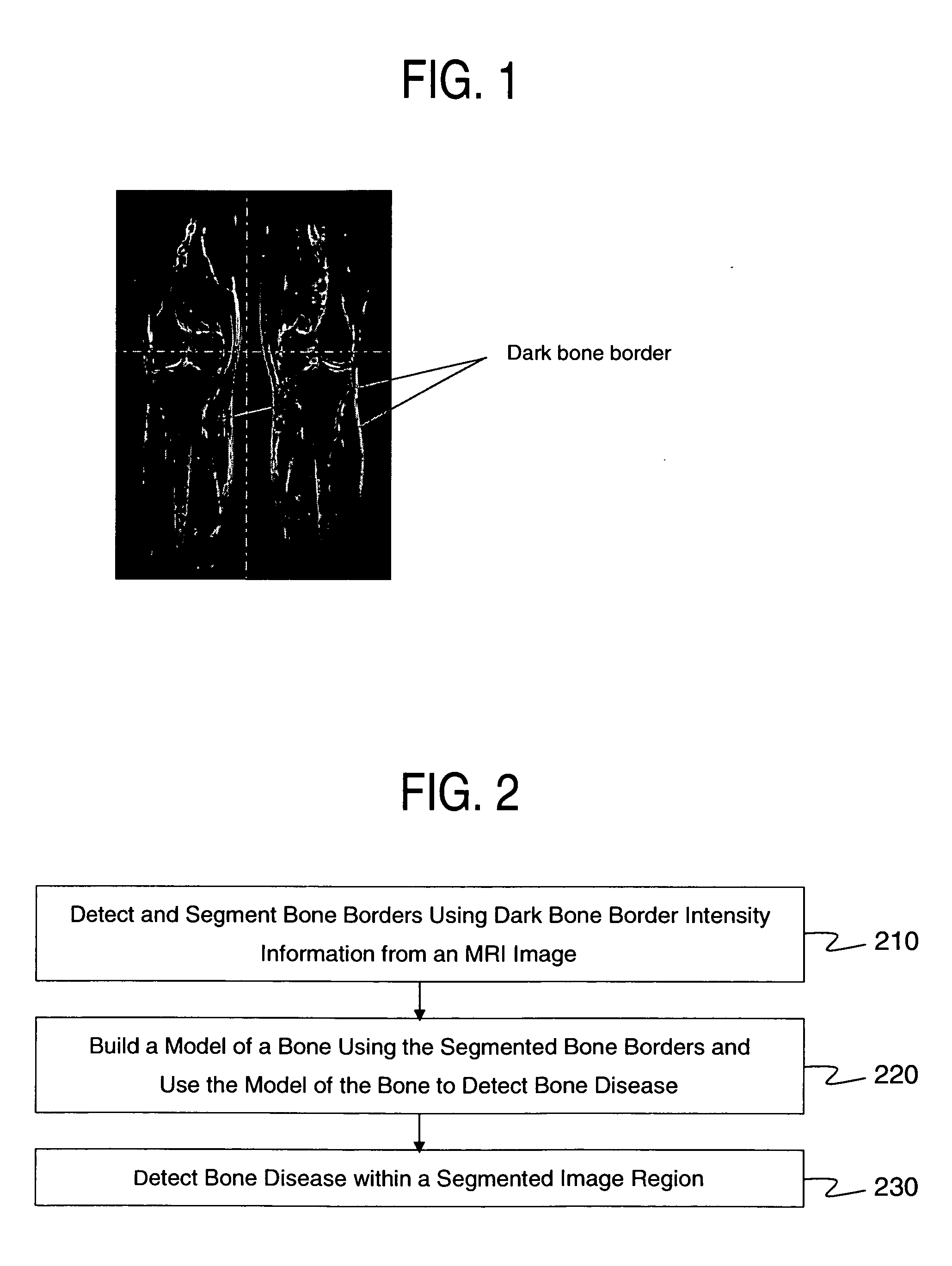 Automatic bone detection in MRI images