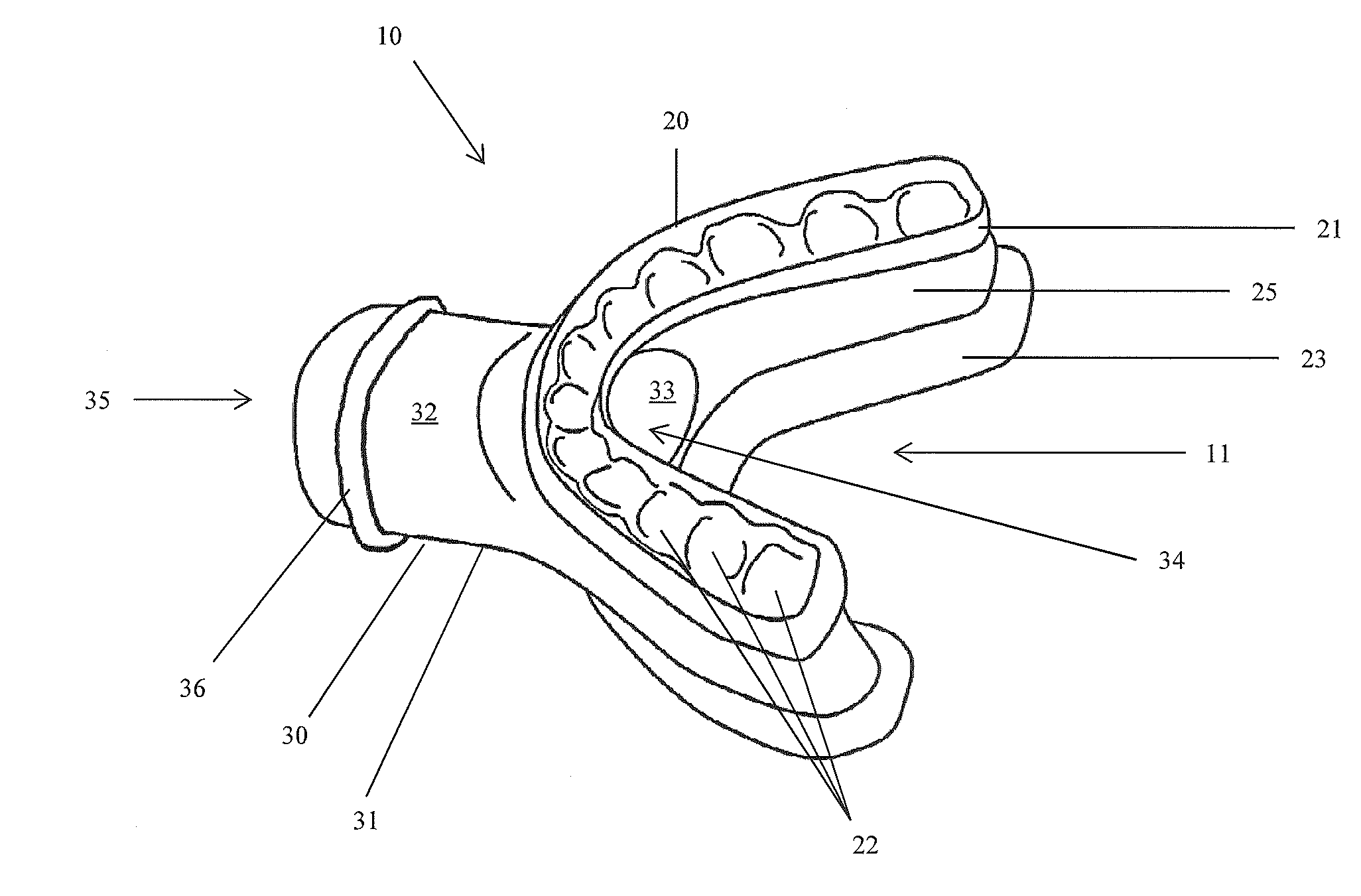 Intraoral mandibular advancing positive pressure apparatus