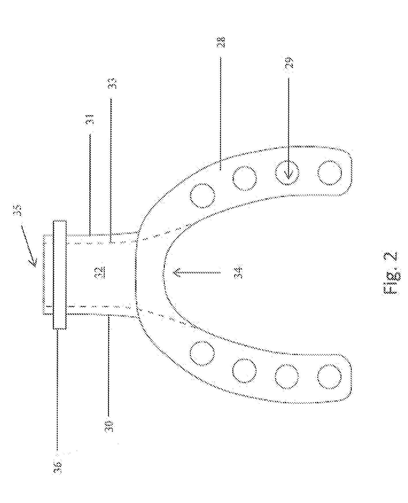 Intraoral mandibular advancing positive pressure apparatus