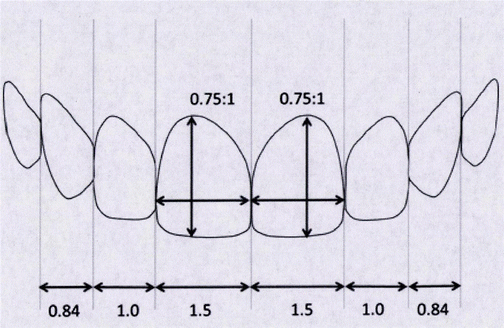 Transparent template used for anterior teeth esthetic diagnosis