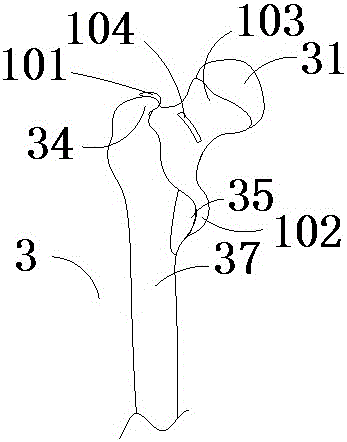 Customized individual artificial total hip replacement surgery femur preparation template system