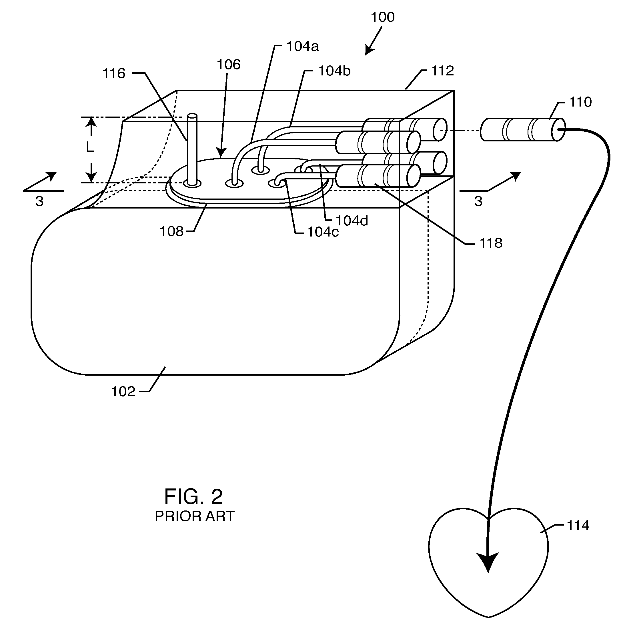 Tank filters adaptable for placement with a guide wire, in series with the lead wires or circuits of active medical devices to enhance MRI compatibility