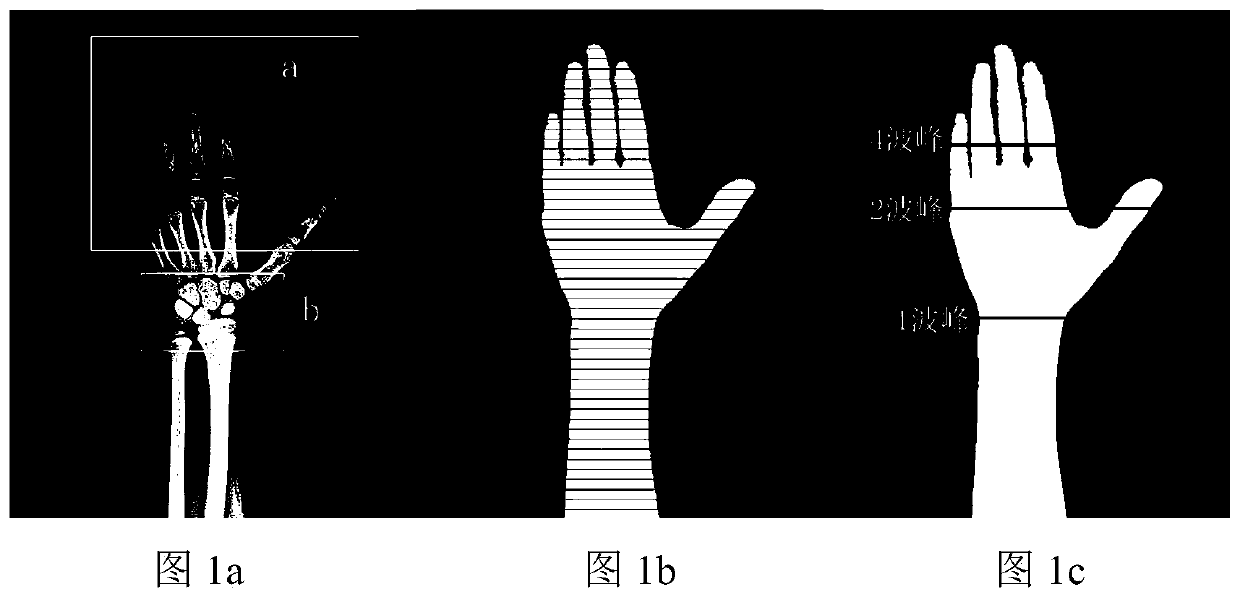 CHN method region of interest extraction method based on shape information and convolutional neural network