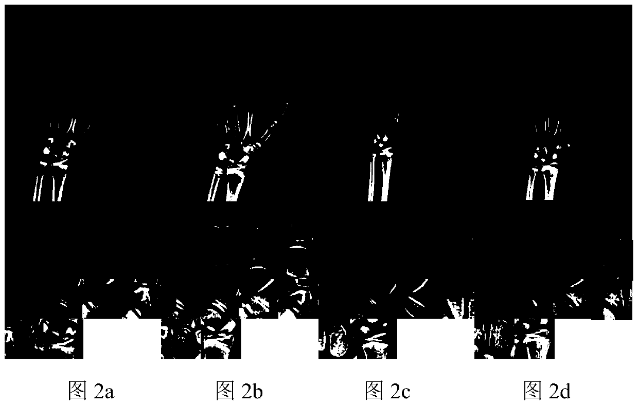 CHN method region of interest extraction method based on shape information and convolutional neural network