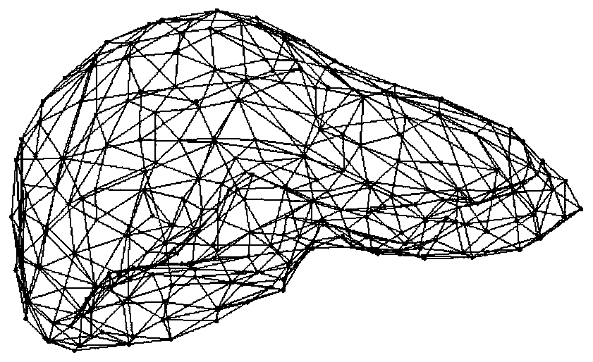 Non-linear particle spring soft tissue deformation simulation method