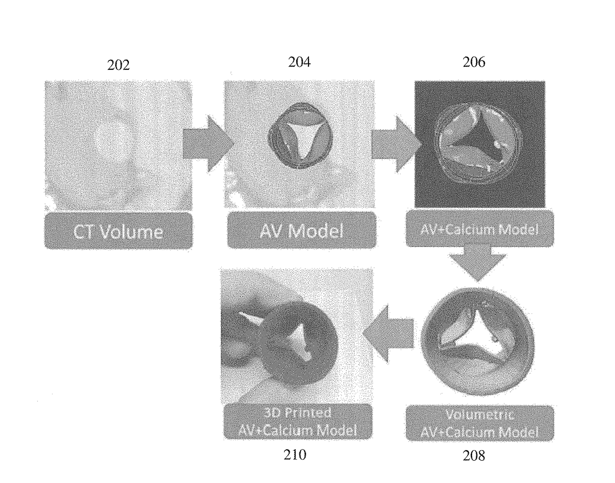 Method and system for advanced transcatheter aortic valve implantation planning