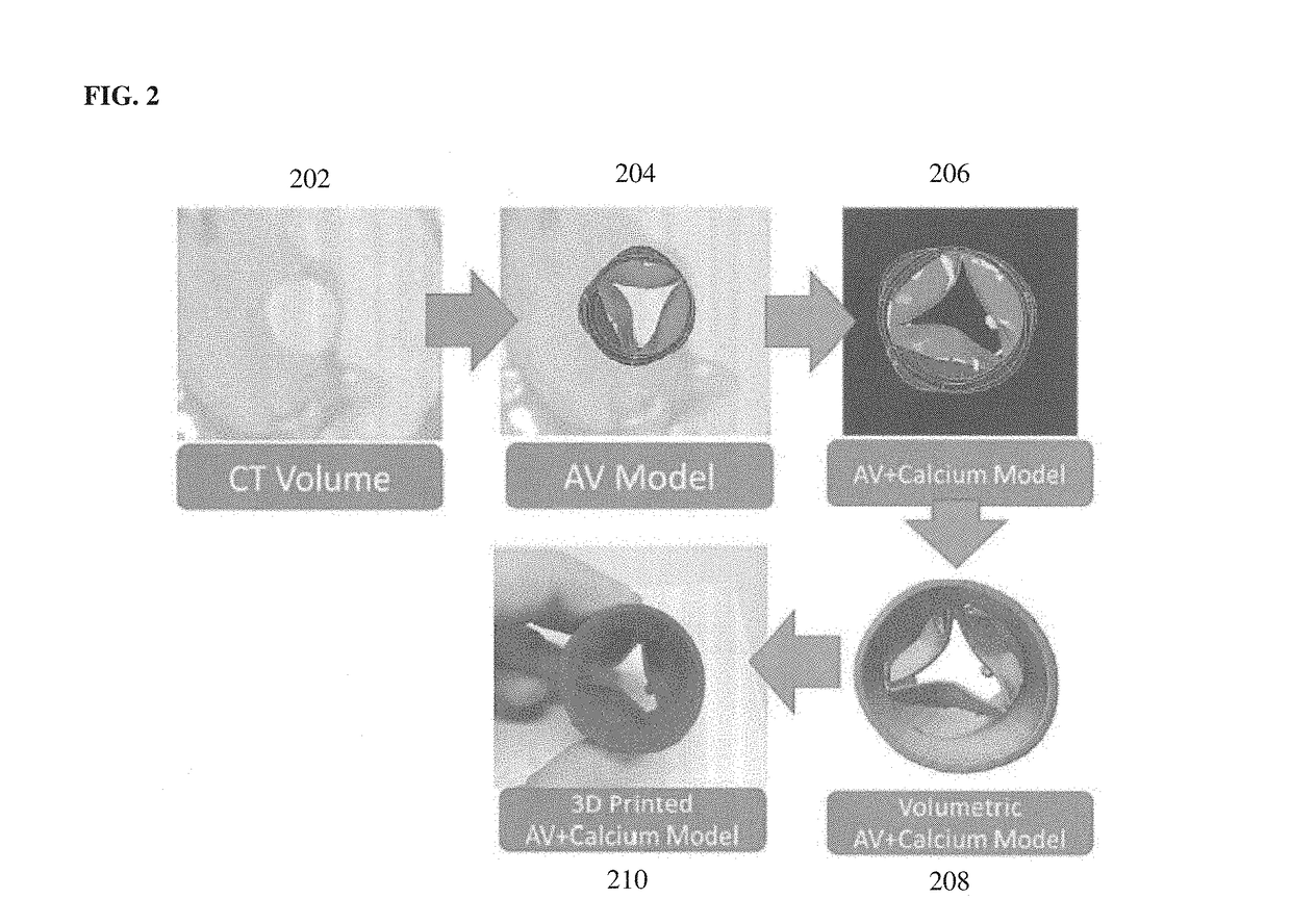 Method and system for advanced transcatheter aortic valve implantation planning