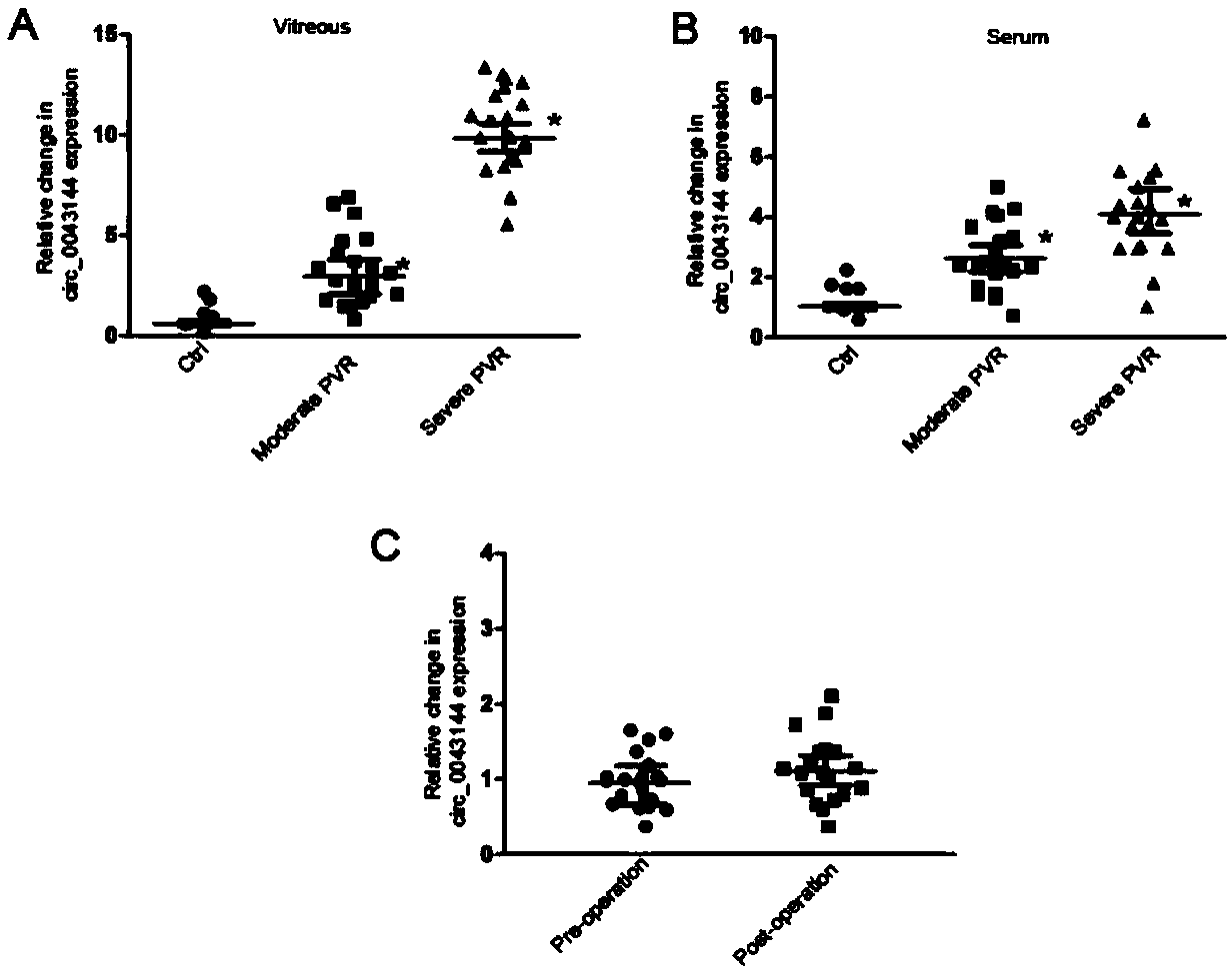 Application of circRNA in preparation of diagnostic reagent for proliferative vitreoretinopathy