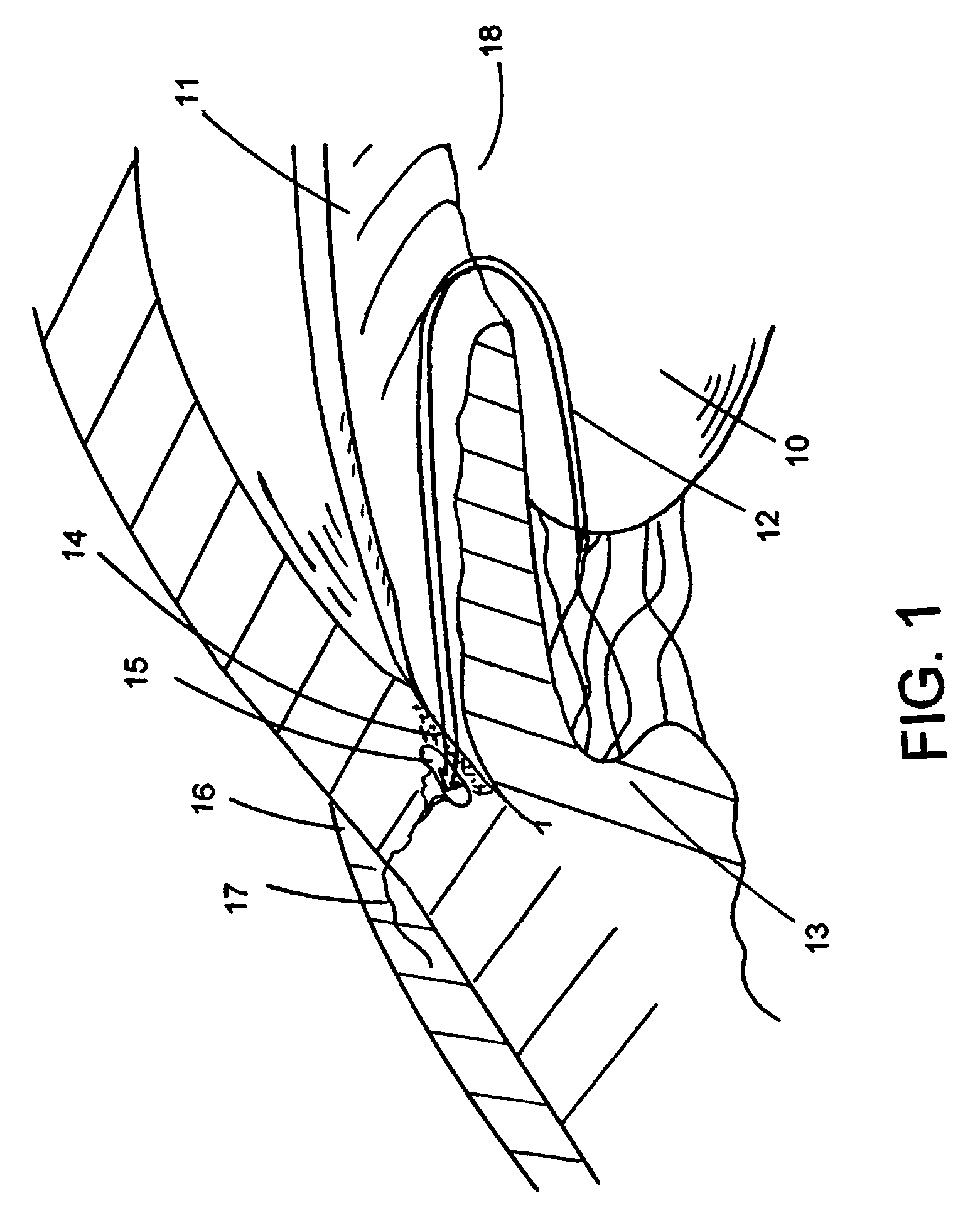 Optically powered and optically data-transmitting wireless intraocular pressure sensor device