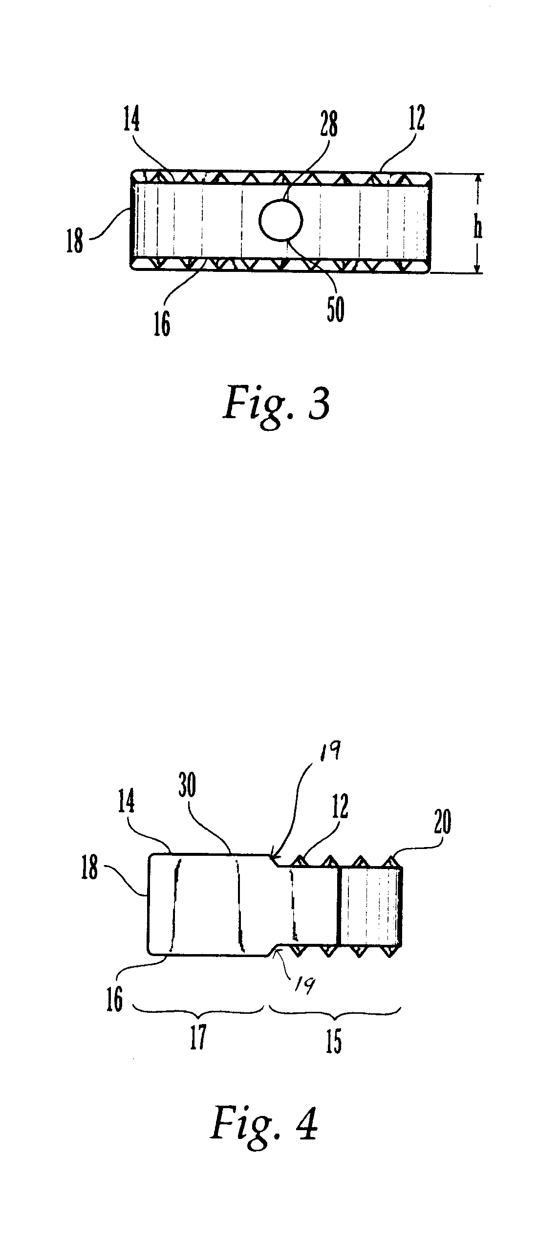 Multipiece allograft implant