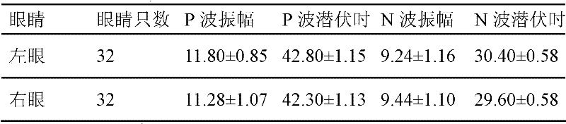 Application of digitoflavone-7-O-beta-D-glucuronide in fundus disease treatment