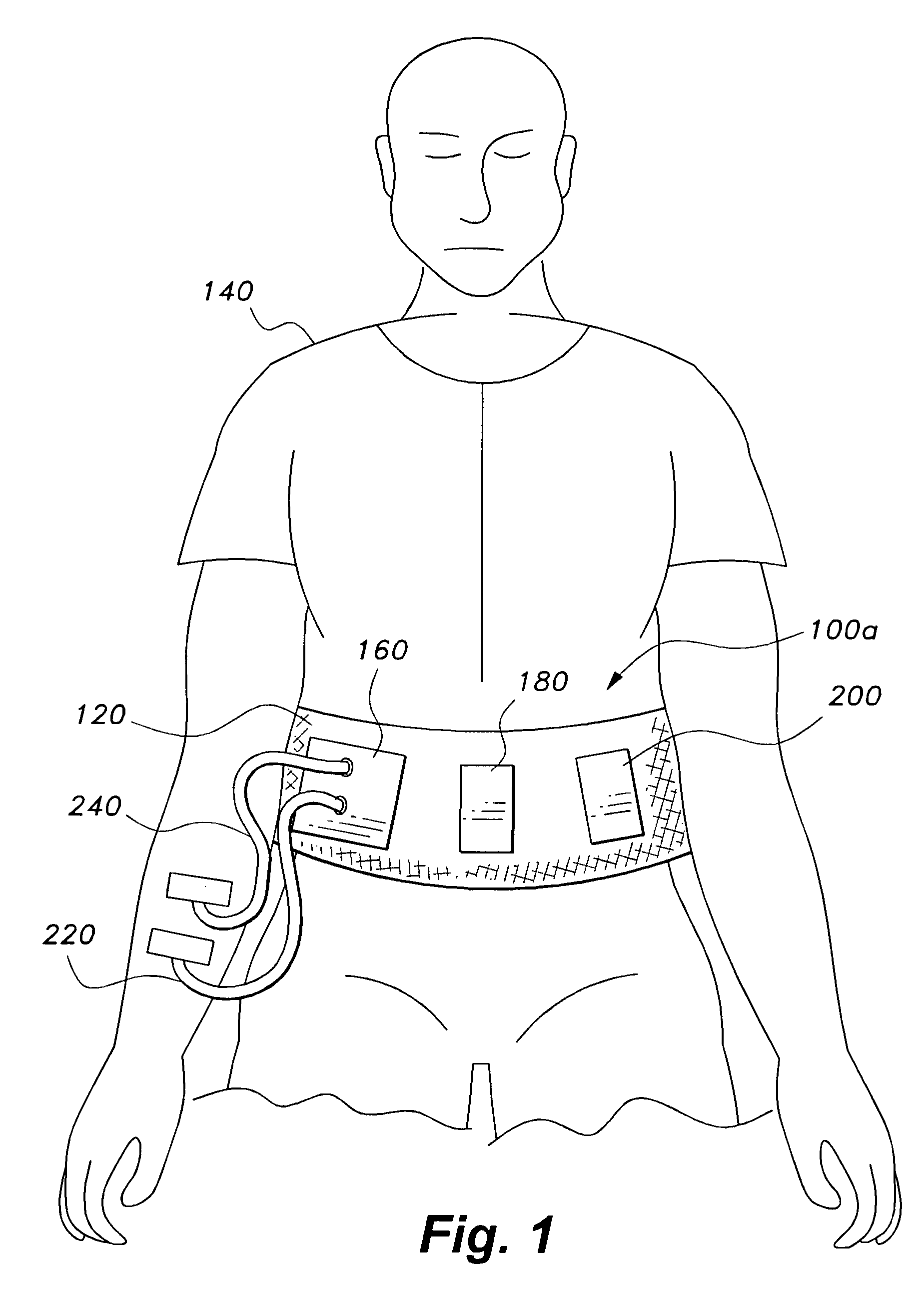 Dialysis device