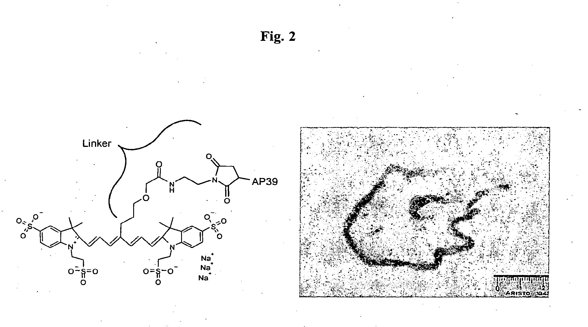 Use of cyanine dyes for the diagnosis of proliferative diseases