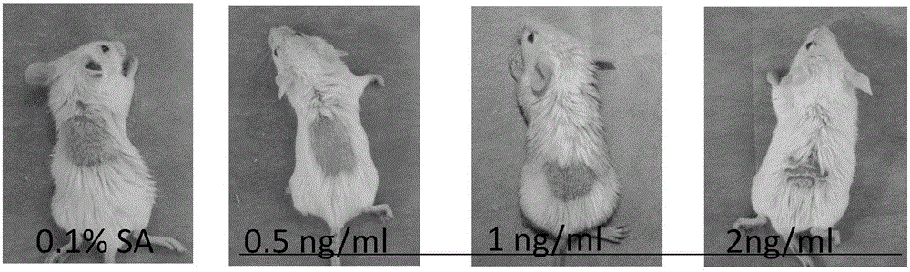 Application of Cornulin as target in preparation of drug for preventing and treating psoriasis