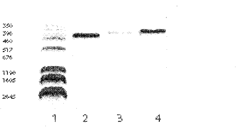 Gene expression product of extro-cellular domain amino end of human thyrotropin receptor, its preparing method and application in enzyme immune technology