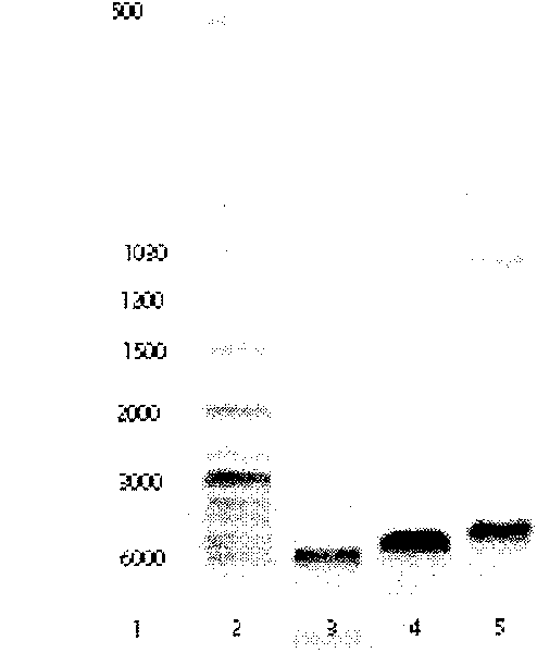 Gene expression product of extro-cellular domain amino end of human thyrotropin receptor, its preparing method and application in enzyme immune technology