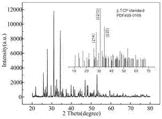 Compound bone cement with high inorganic components as well as preparation method and application of compound bone cement