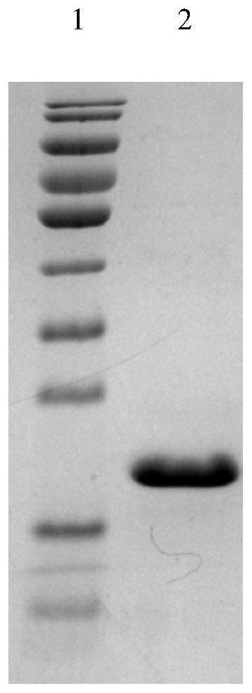 A kind of soluble human ige receptor protein truncated protein and its preparation method and application