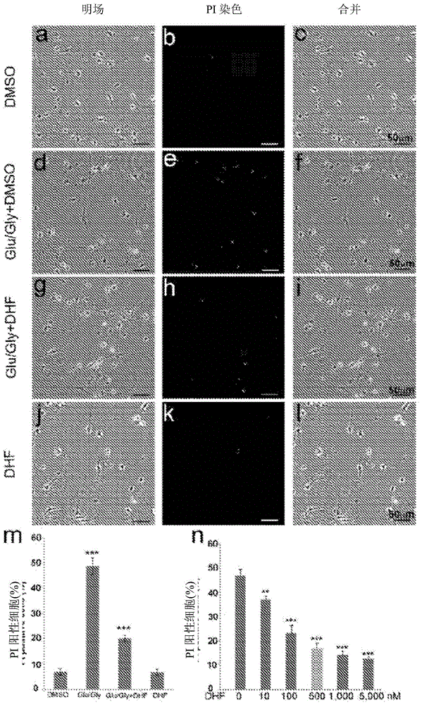 Compositions and methods of treating and preventing neuronal damage from traumatic brain injury