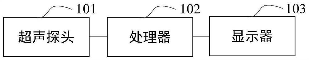 Ultrasonic equipment, ultrasonic image processing method and storage medium