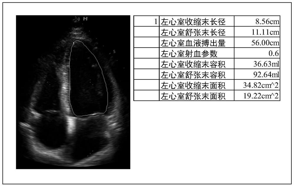 Ultrasonic equipment, ultrasonic image processing method and storage medium