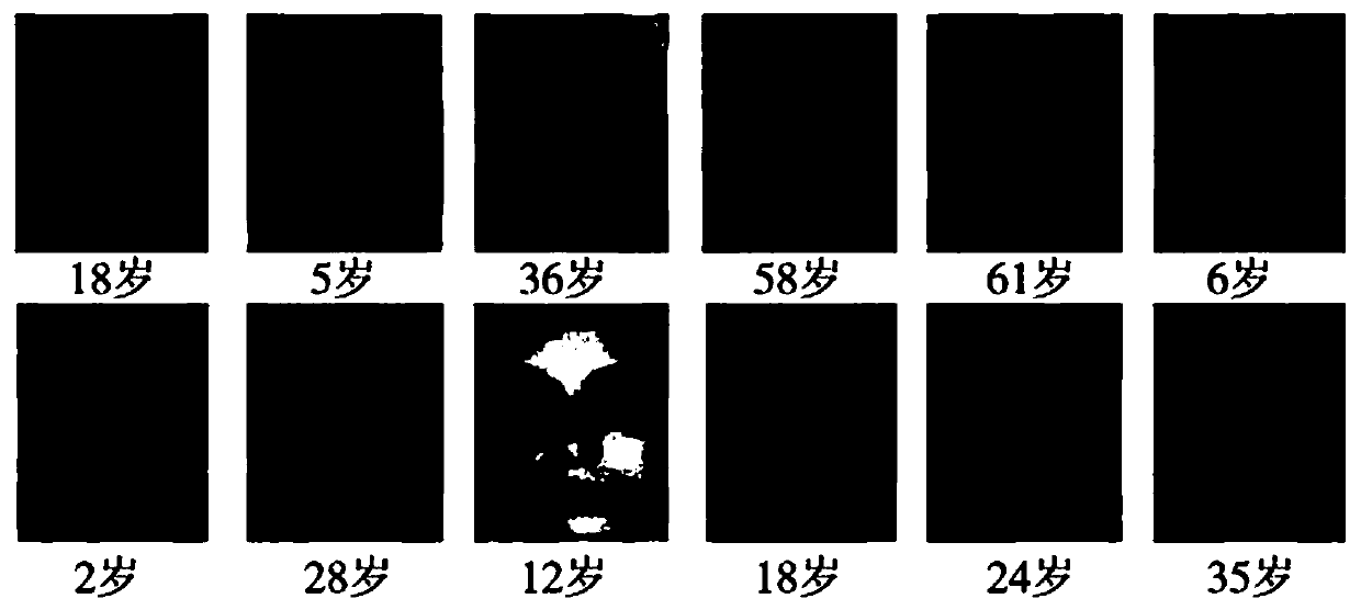 Age interference resistant face recognition method