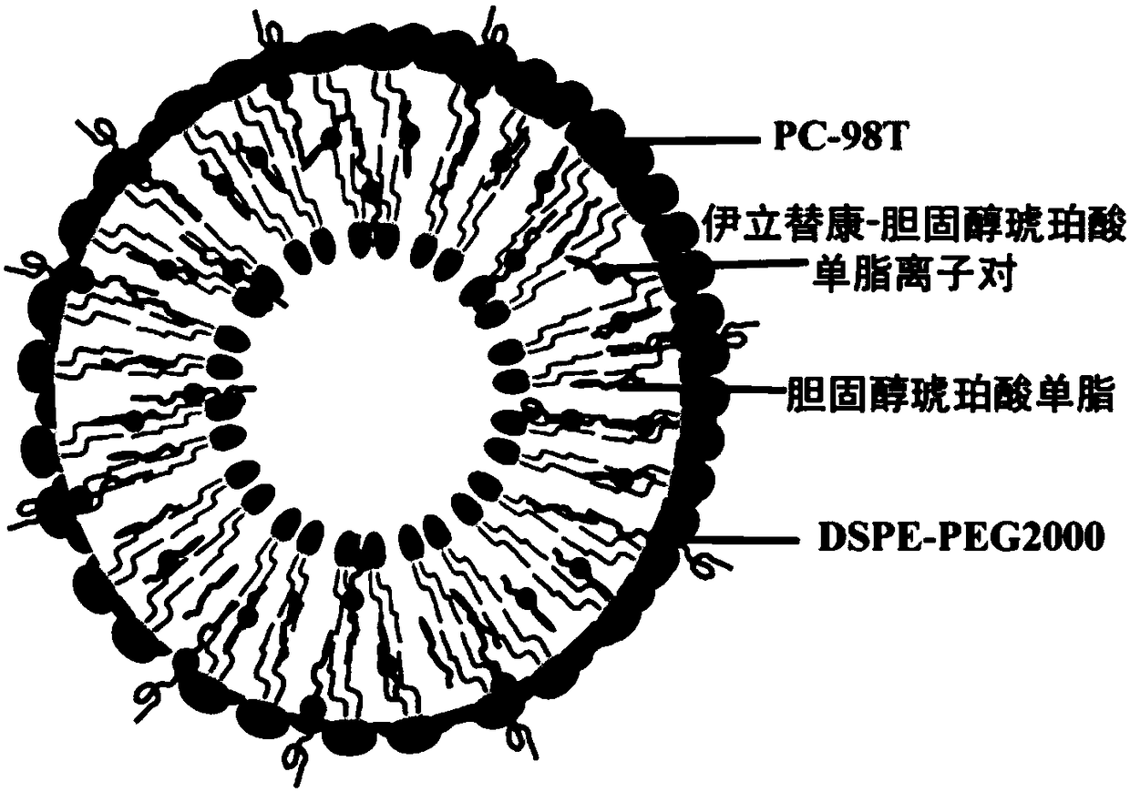 Irinotecan-cholesterol succinic acid simple lipid ion pair, liposome and preparation method and application thereof