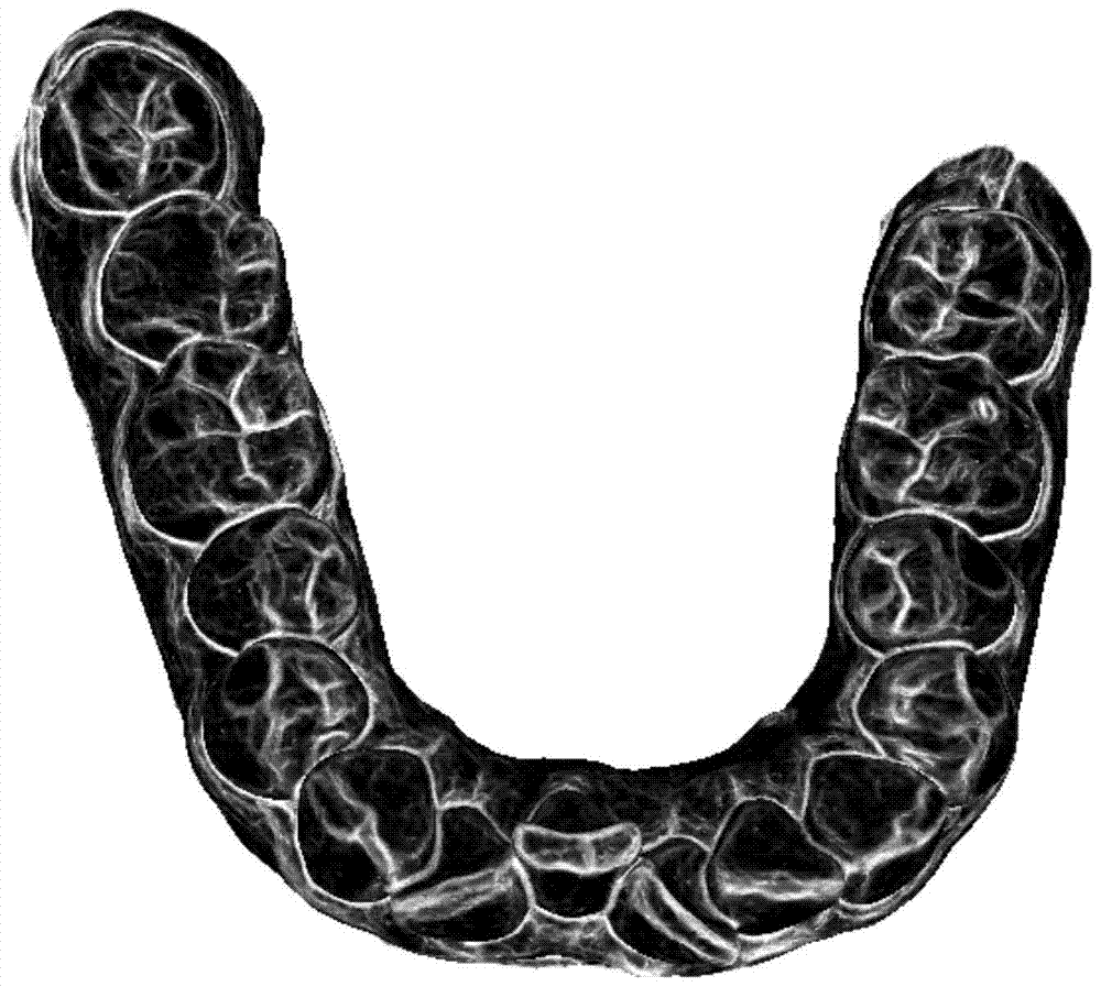 A Method of Automatically Segmenting Triangular Mesh Model of Full Jaw Teeth