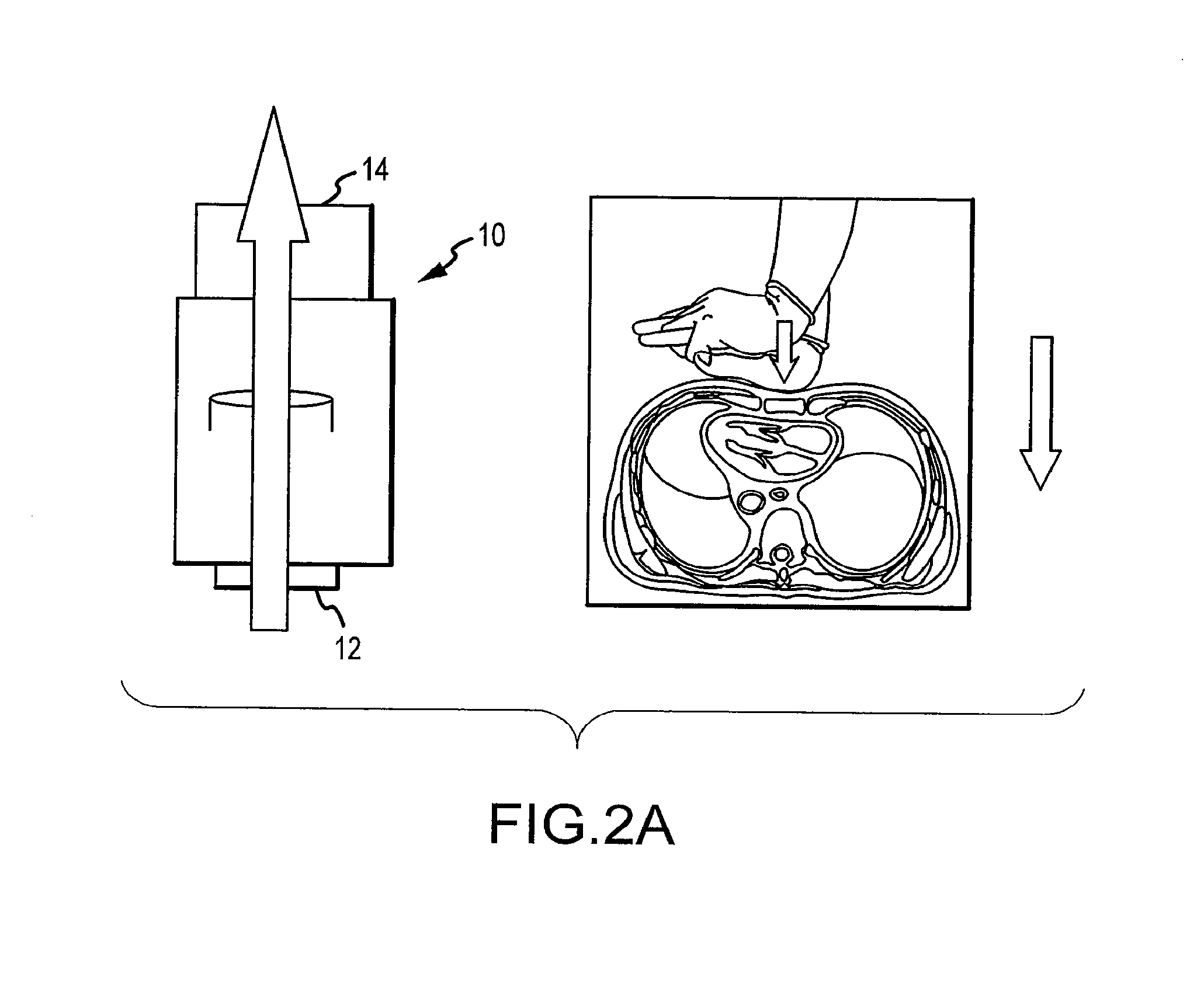 Volume exchanger valve system and method to increase circulation during CPR