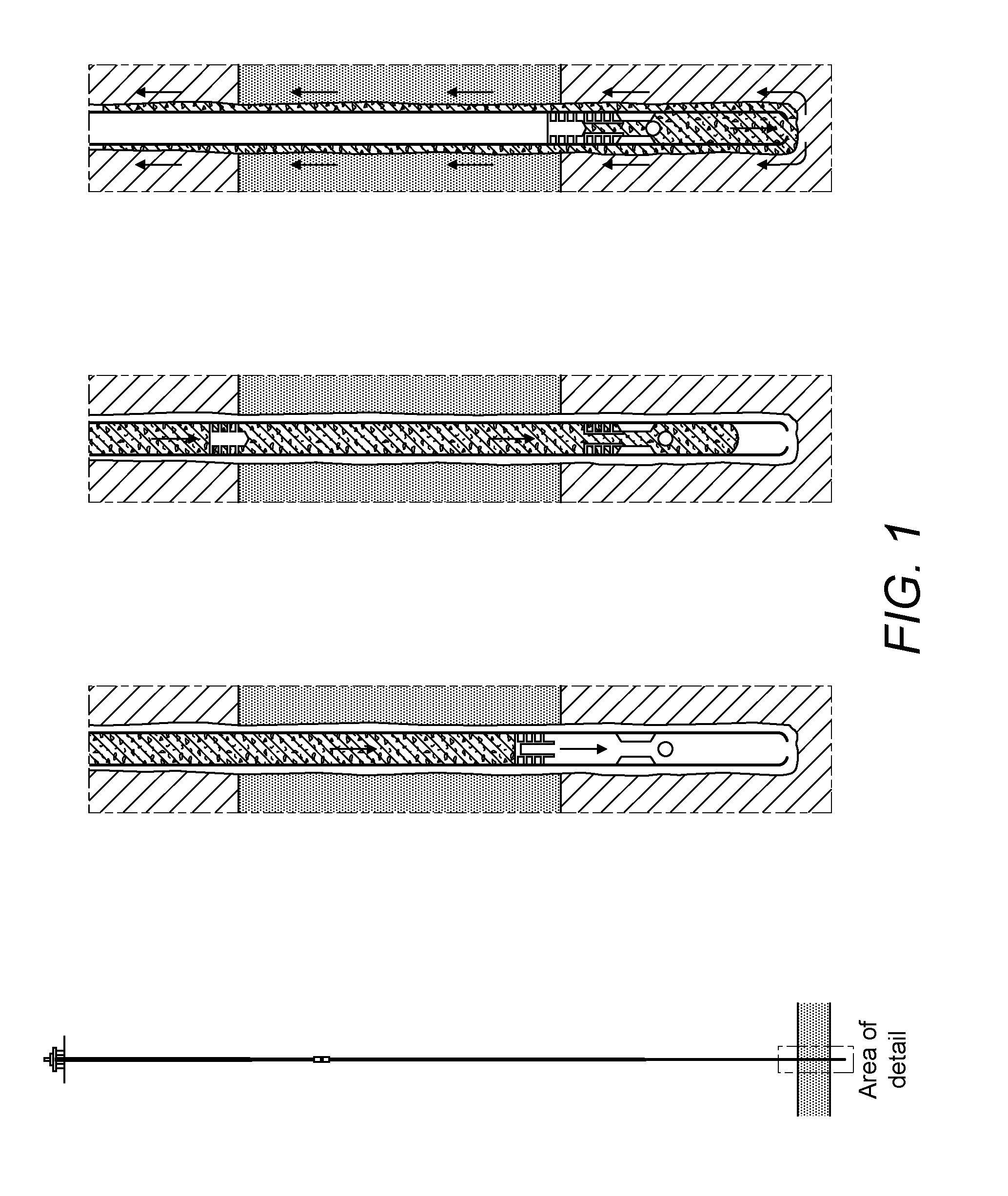 Wellbore encasement