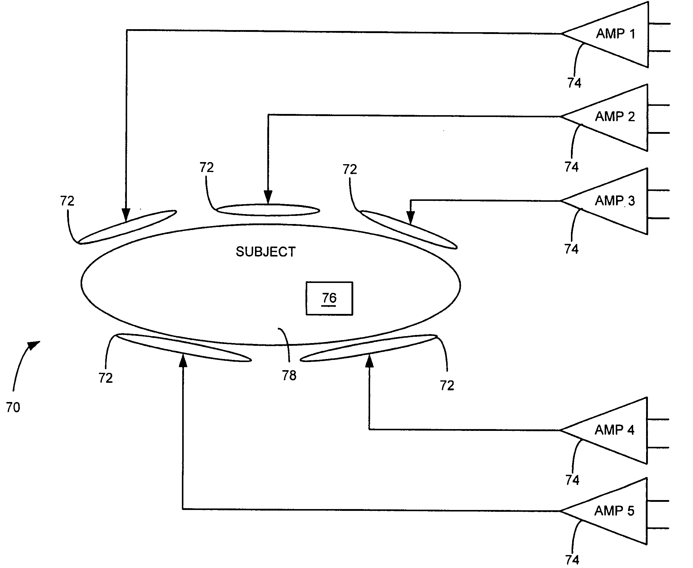 Method and apparatus to generate an RF excitation consistent with a desired excitation profile using a transmit coil array