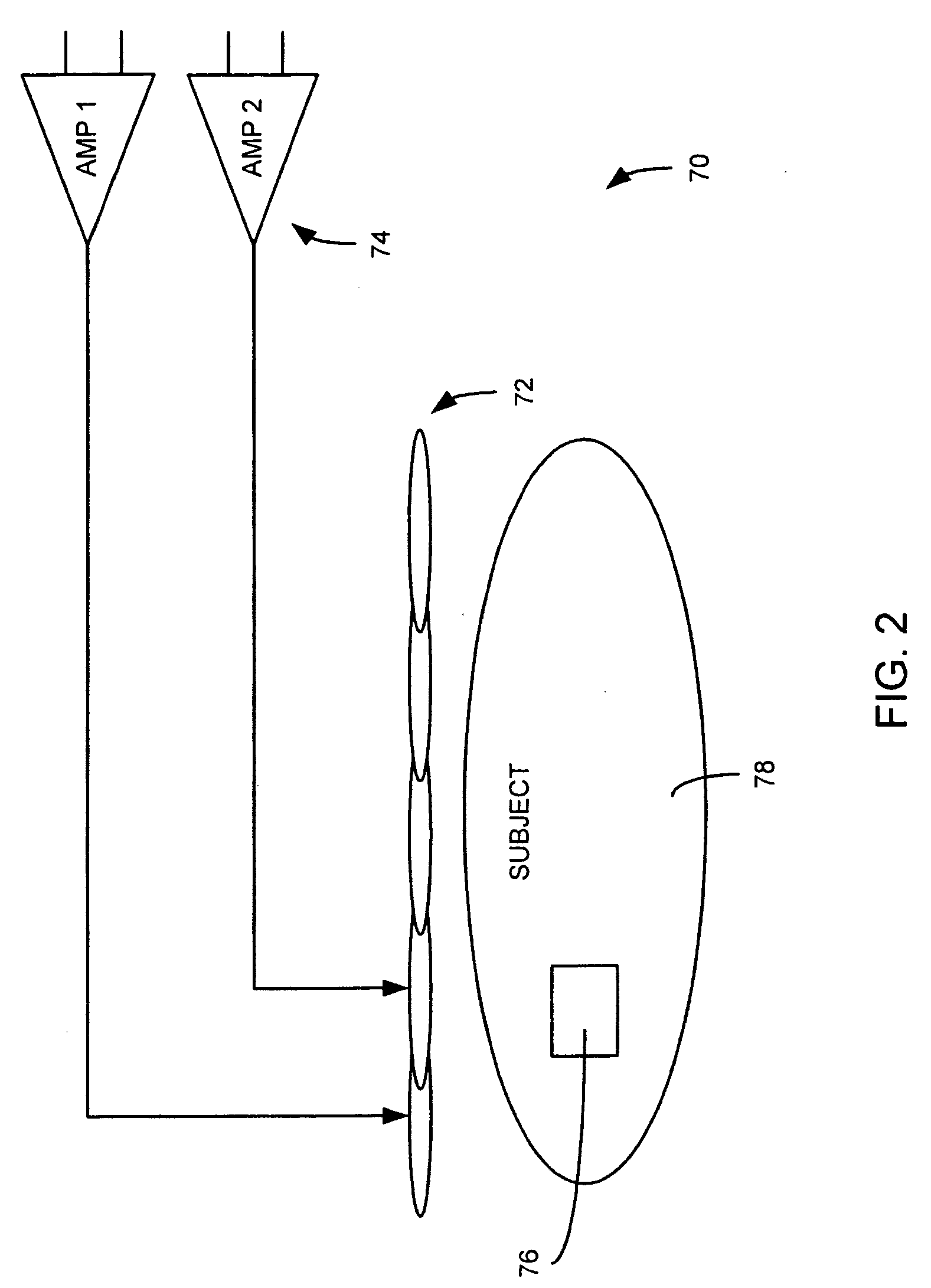 Method and apparatus to generate an RF excitation consistent with a desired excitation profile using a transmit coil array