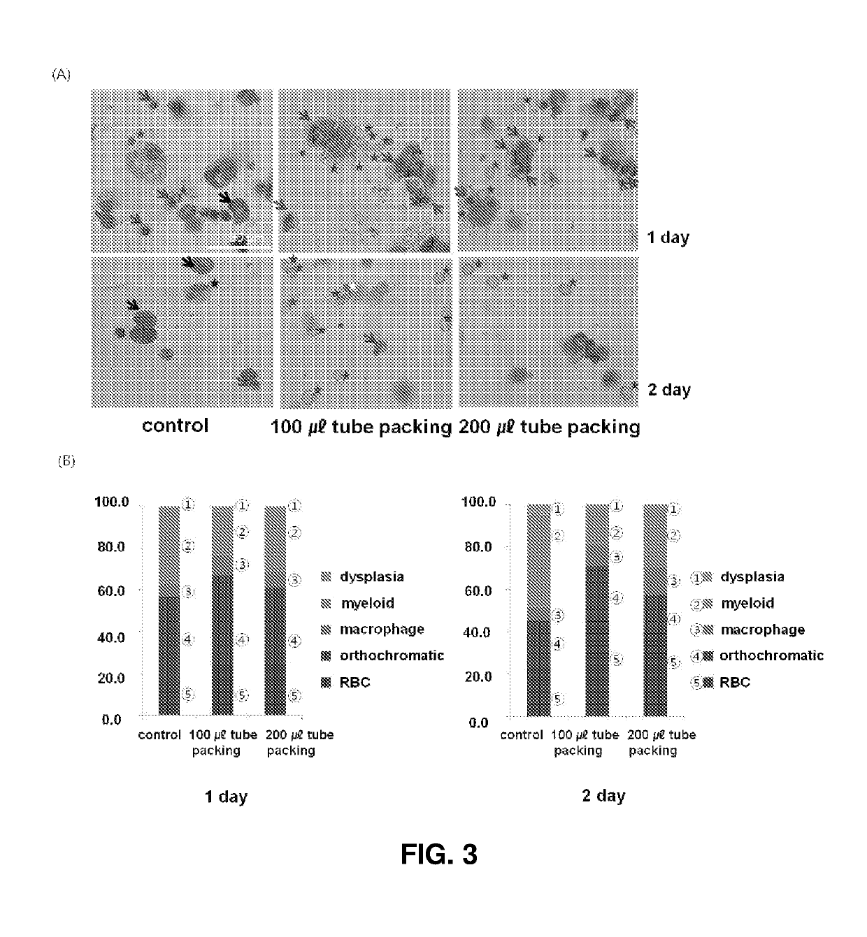 In vitro expansion of erythroid cells