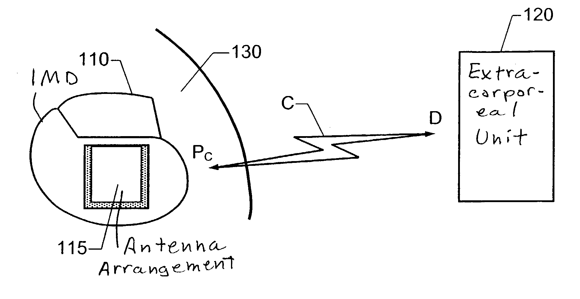 Implantable antenna for use with an implantable medical device