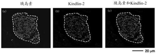 Application of kindlin-2 protein as a target in the preparation of drugs for treating diabetes