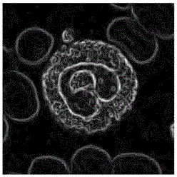 Nucleus segmentation method based on white blood cell detection