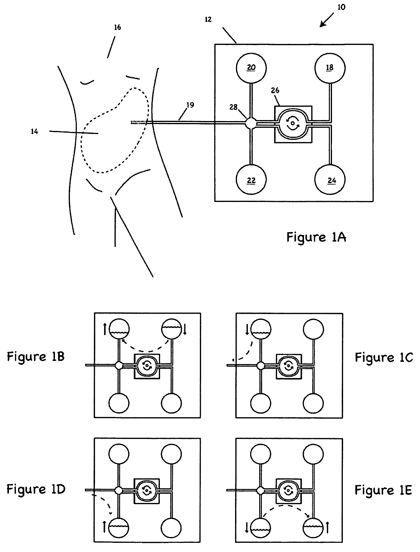 Apparatus and methods for early stage peritonitis detection including self-cleaning effluent chamber