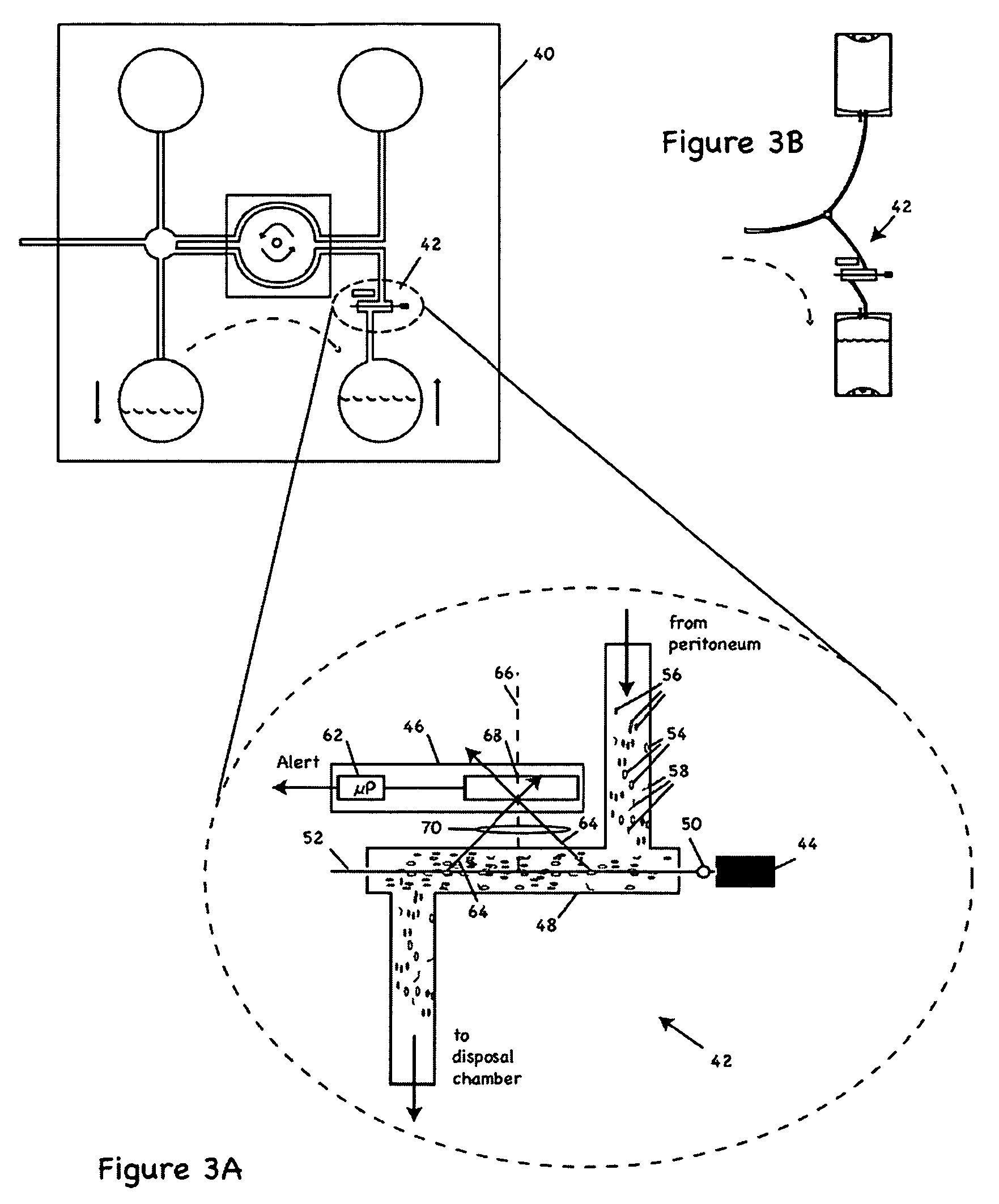 Apparatus and methods for early stage peritonitis detection including self-cleaning effluent chamber