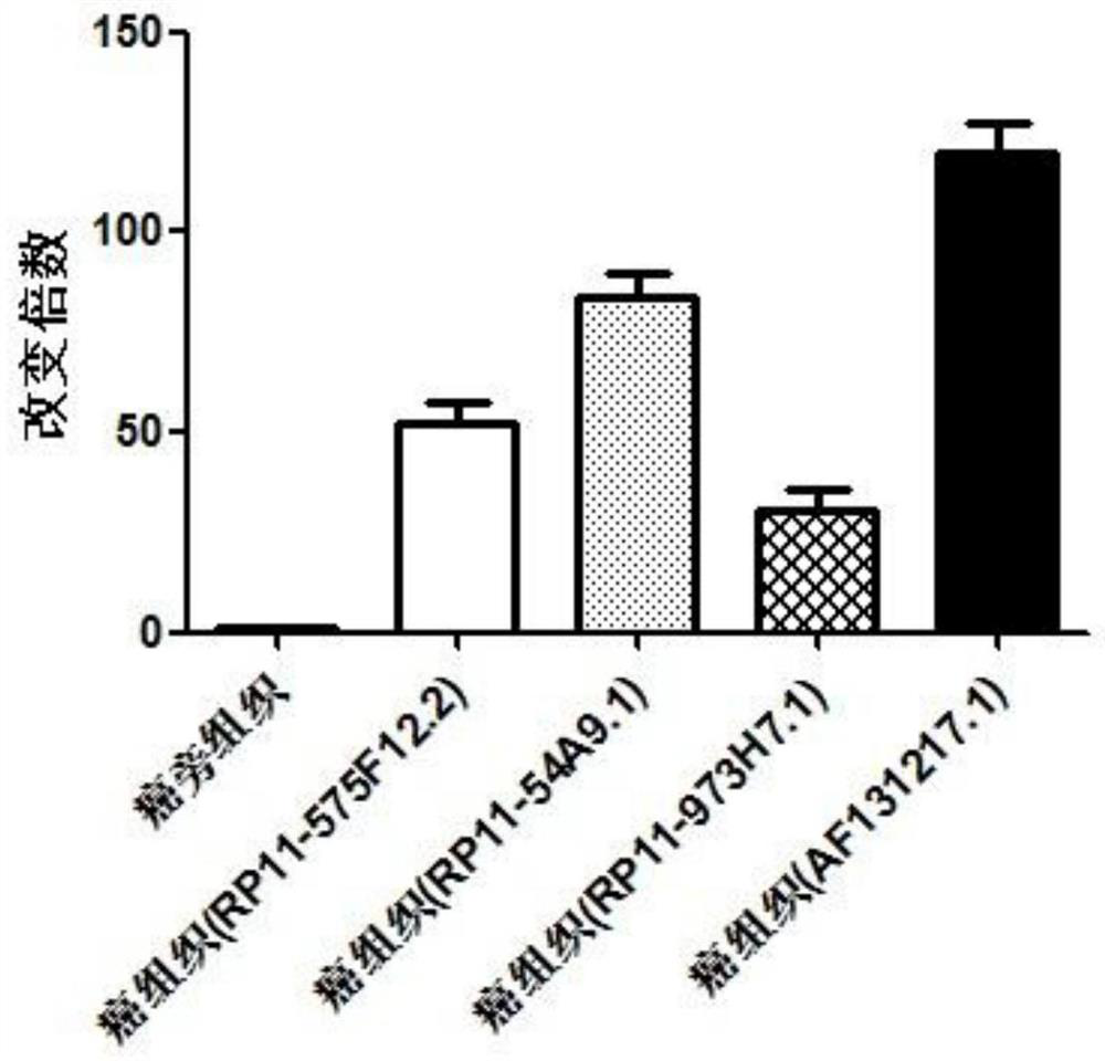 Application of biomarker RP11-54A9.1 in prediction of oral squamous cell carcinoma and treatment of oral squamous cell carcinoma