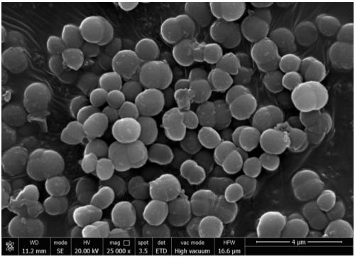 Microbial mineralized cementation treatment liquid and sandy slope treatment method