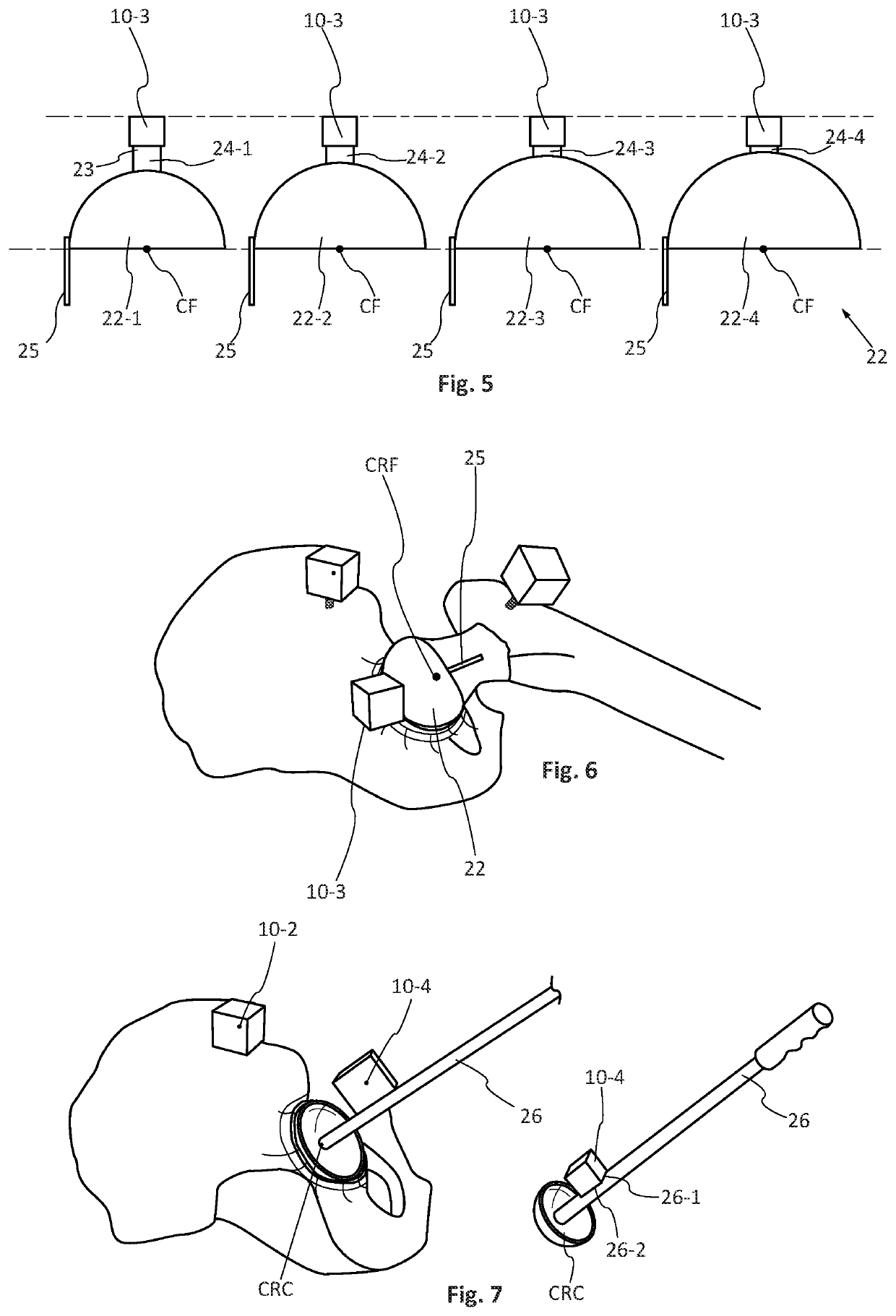 Method and device for assisting a surgeon fit a prosthesis, in particular a hip prosthesis, following different surgical protocols